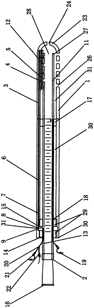 Negative-pressure double-sleeve drainage tube