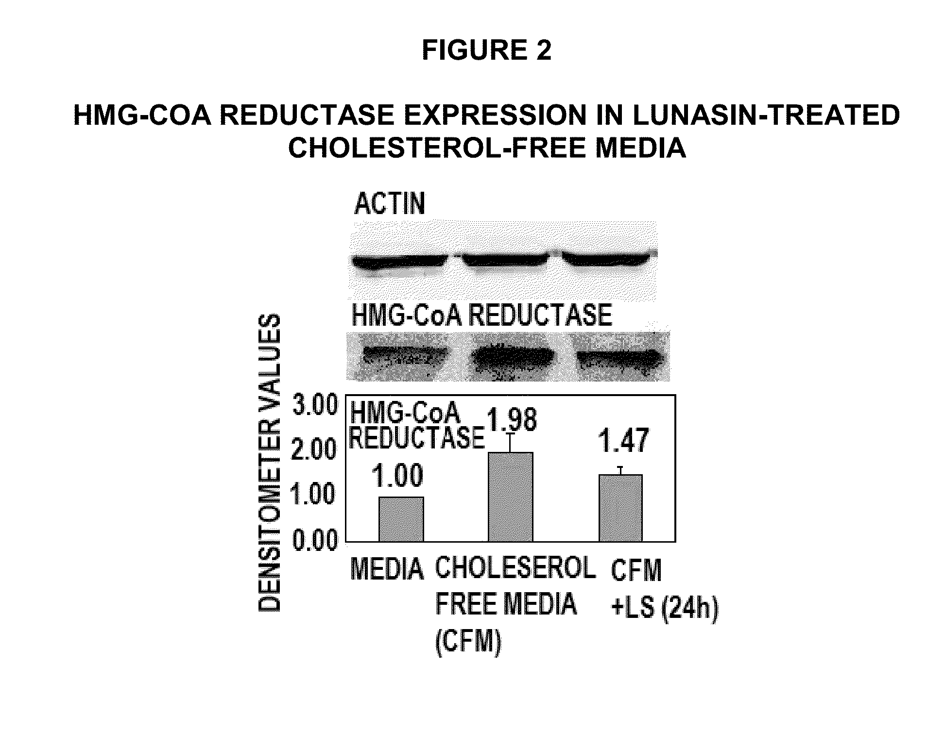 Methods for using soy peptides to inhibit h3 acetylation, reduce expression of HMG-coa reductase and increase LDL receptor and sp1 expression in a mammal