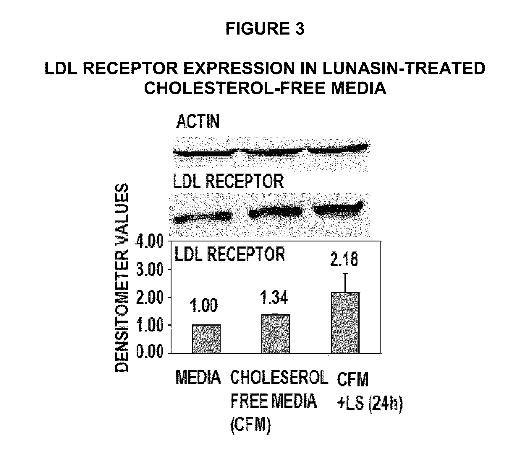 Methods for using soy peptides to inhibit h3 acetylation, reduce expression of HMG-coa reductase and increase LDL receptor and sp1 expression in a mammal