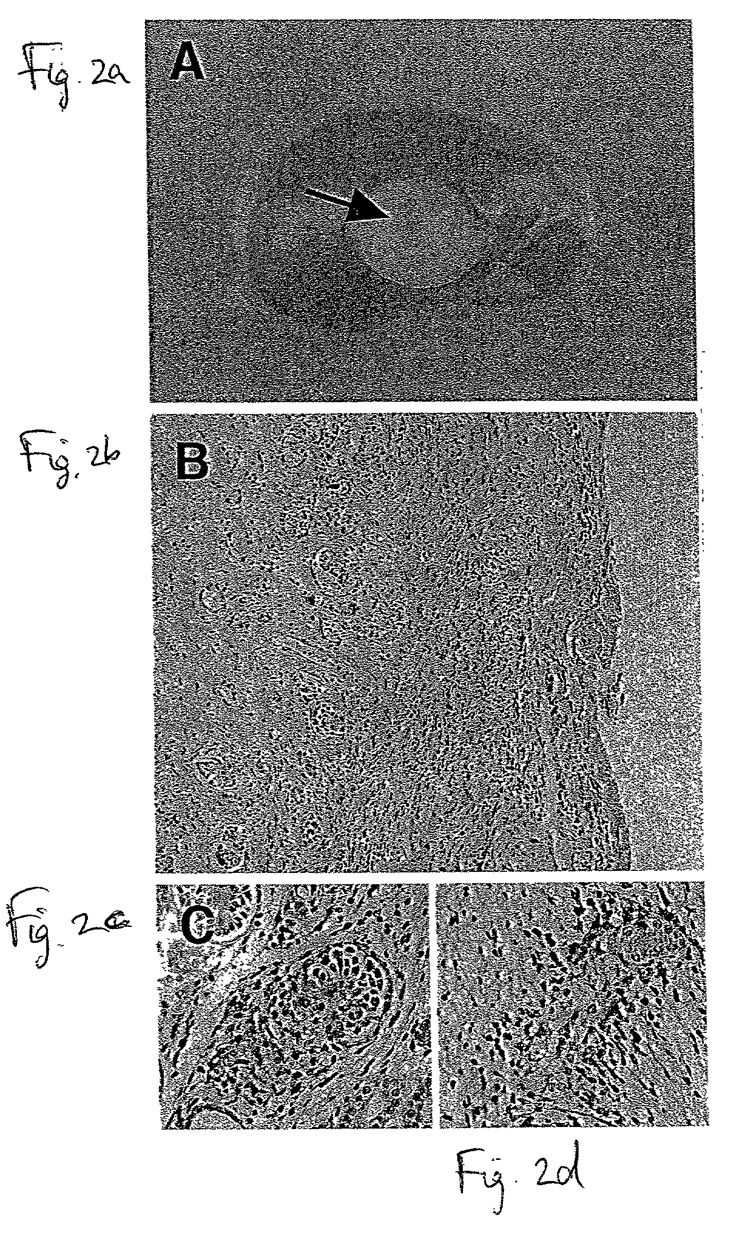 Methods of kidney transplantation utilizing developing nephric tissue