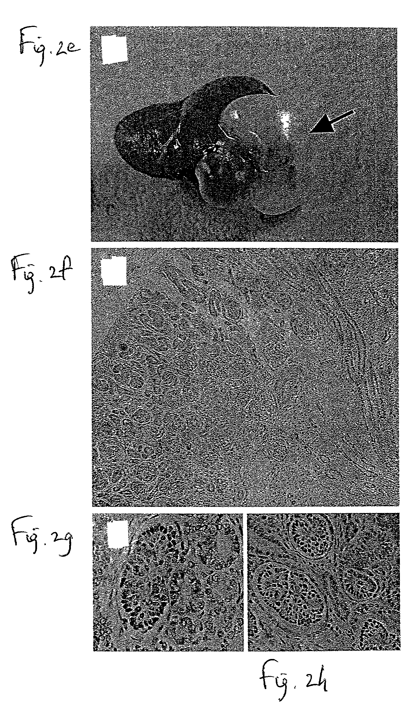 Methods of kidney transplantation utilizing developing nephric tissue