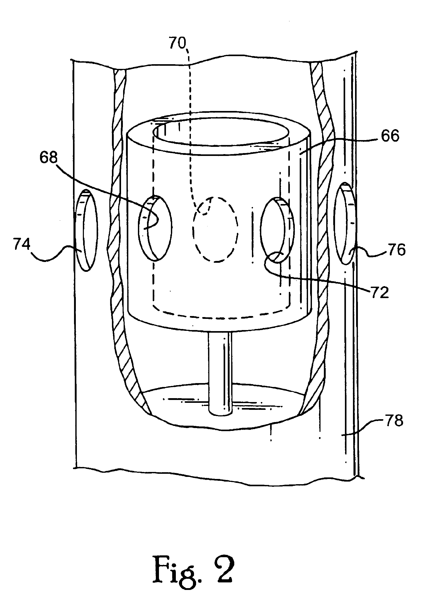 Apparatus and method for providing high frequency variable pressure to a patient