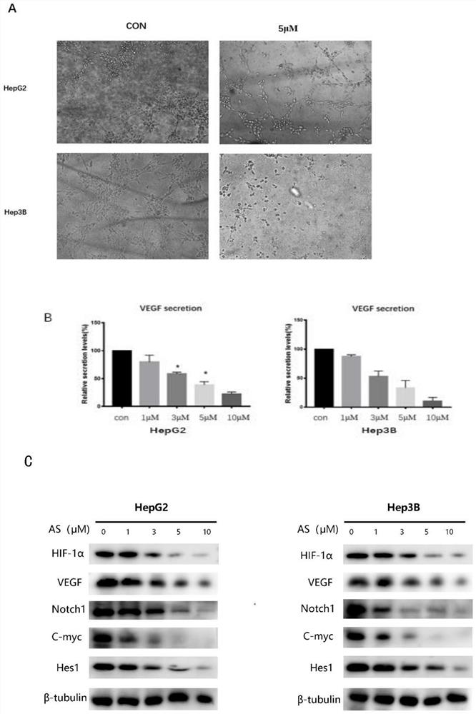 Application of arsenic sulfide to inhibition of angiogenesis, migration and invasion of liver cancer based on inhibition of TRPC6