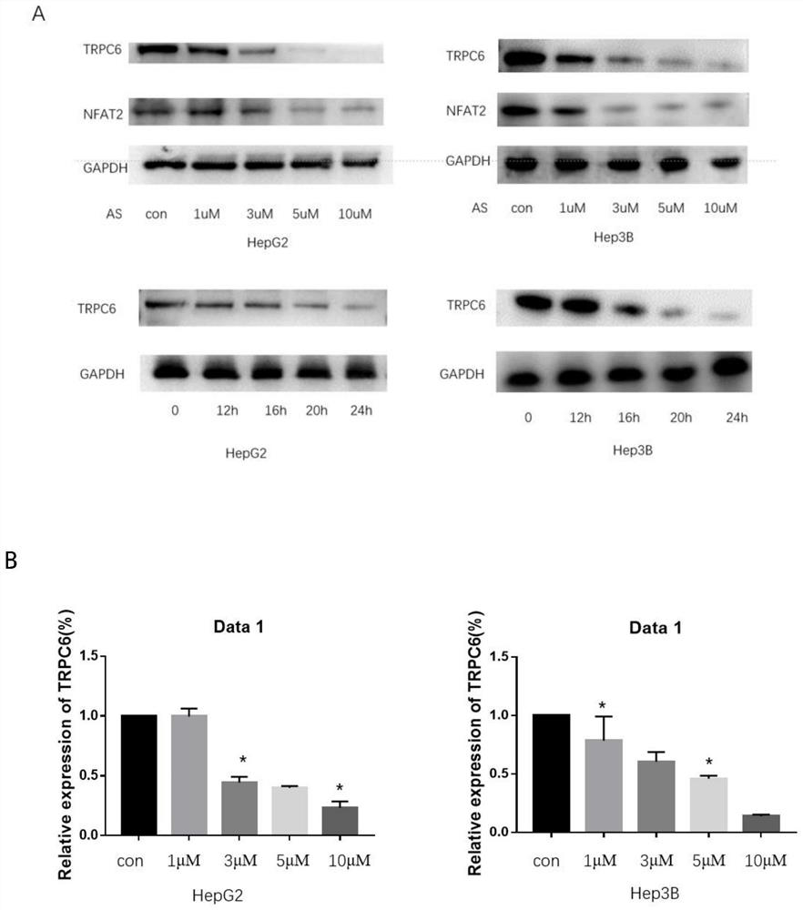 Application of arsenic sulfide to inhibition of angiogenesis, migration and invasion of liver cancer based on inhibition of TRPC6