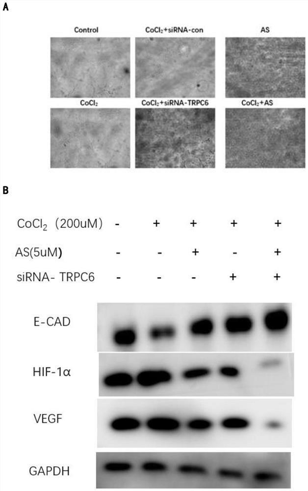 Application of arsenic sulfide to inhibition of angiogenesis, migration and invasion of liver cancer based on inhibition of TRPC6