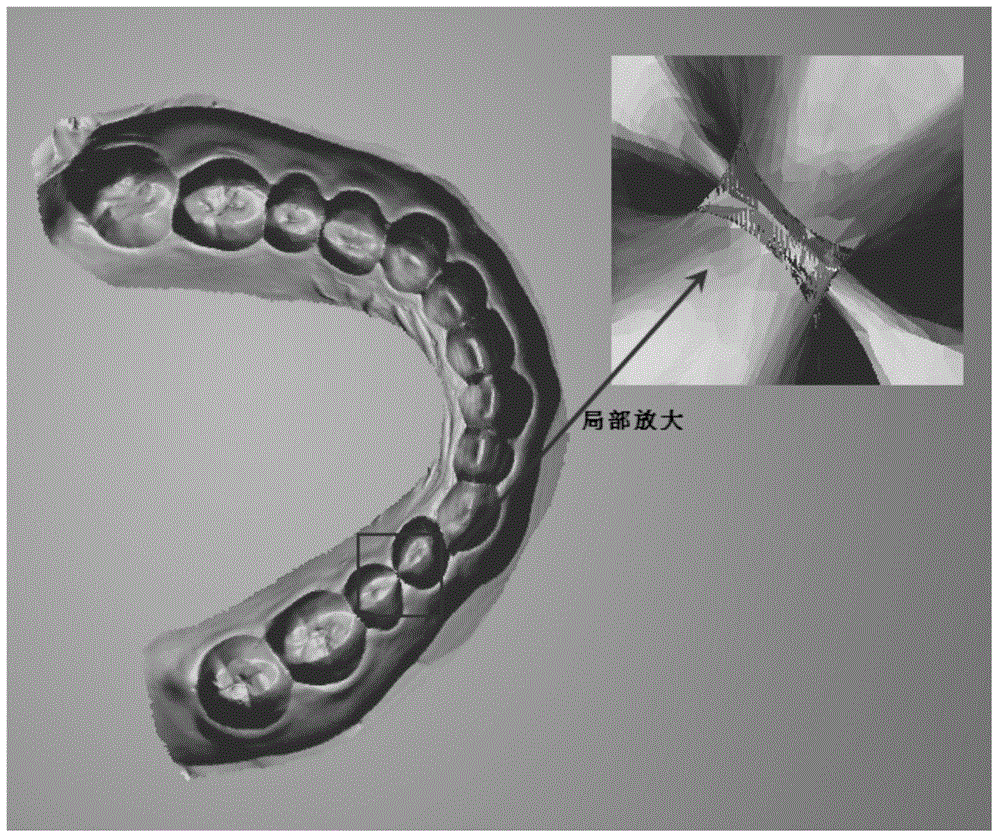 Automatic detection and repairing method of dentulous jaw black triangle