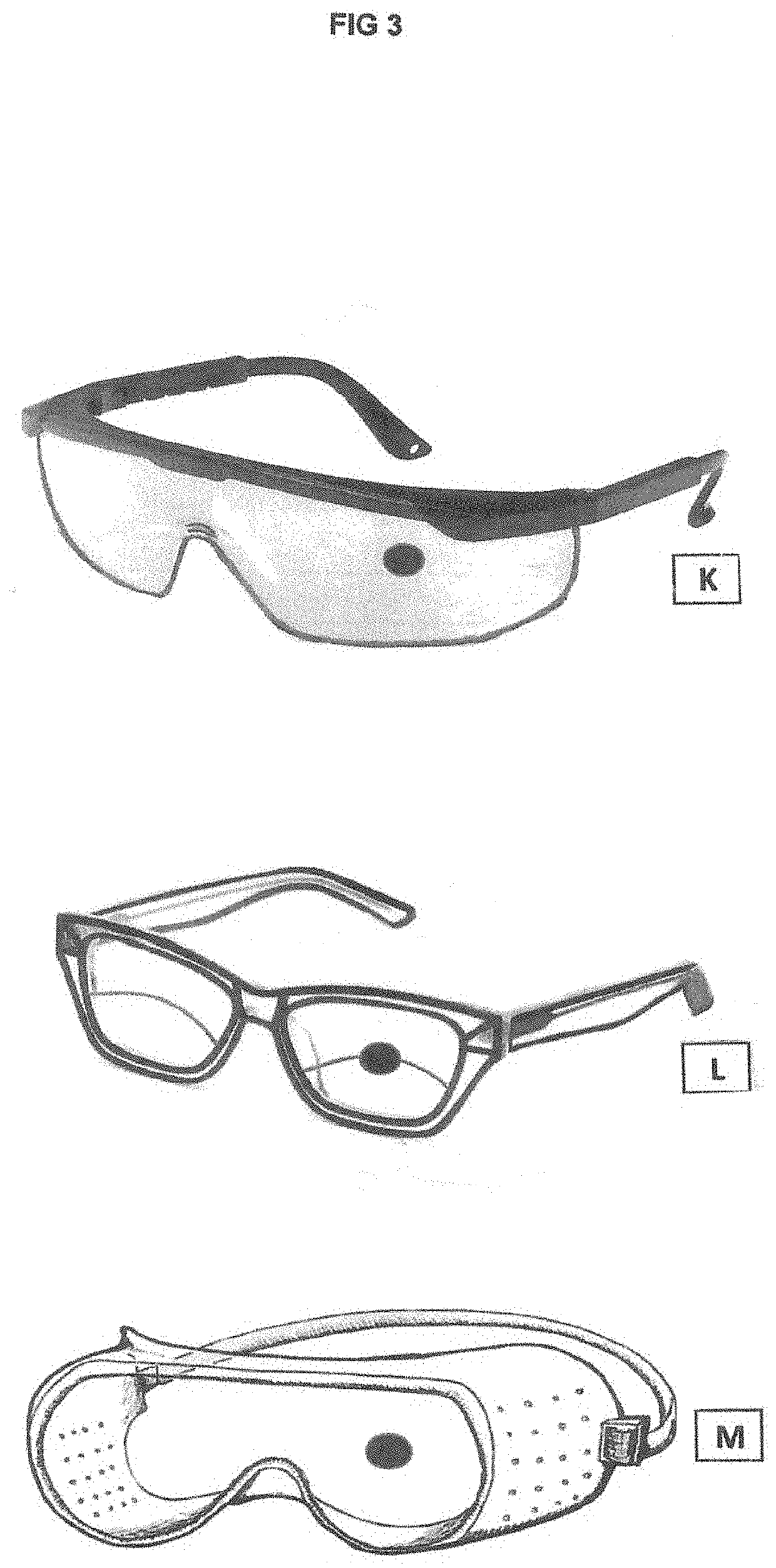 Macular degeneration  stick-on-eyeglass filters to reduce glare and distortion