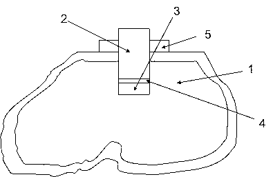 Tuning structure