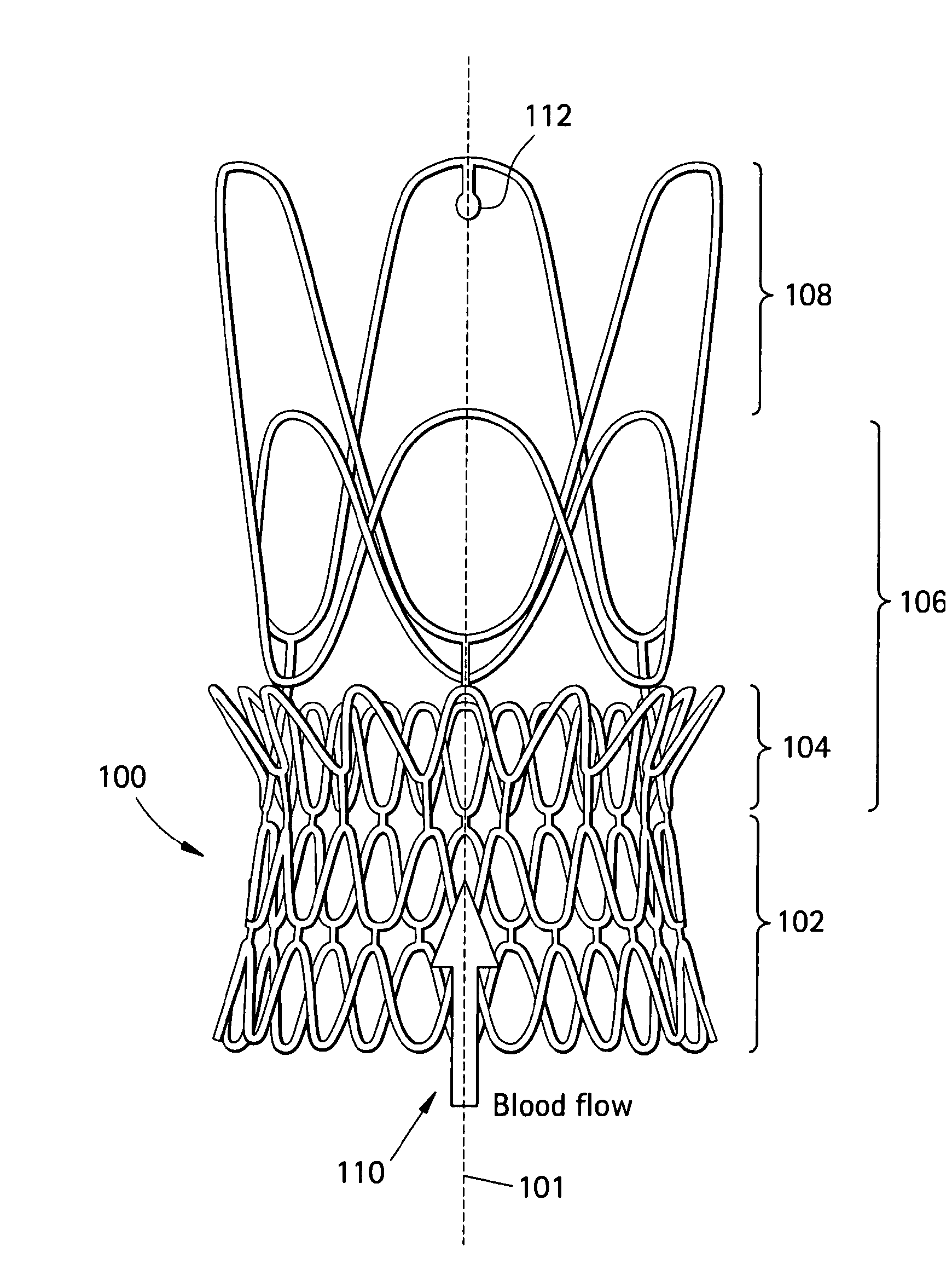 Stents, Valved-Stents, and Methods and Systems for Delivery Thereof