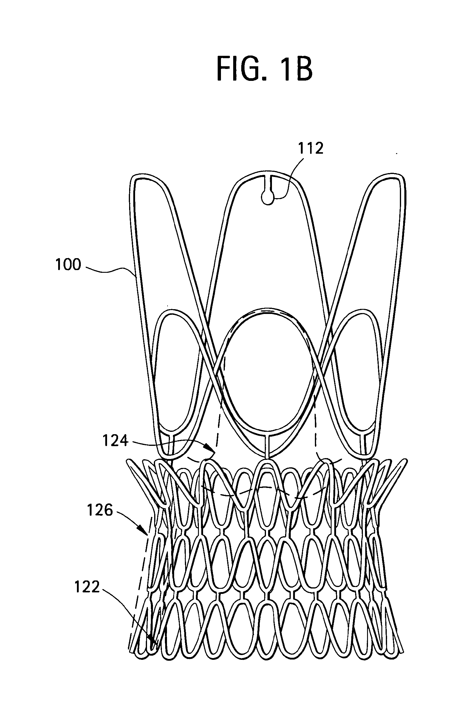 Stents, Valved-Stents, and Methods and Systems for Delivery Thereof