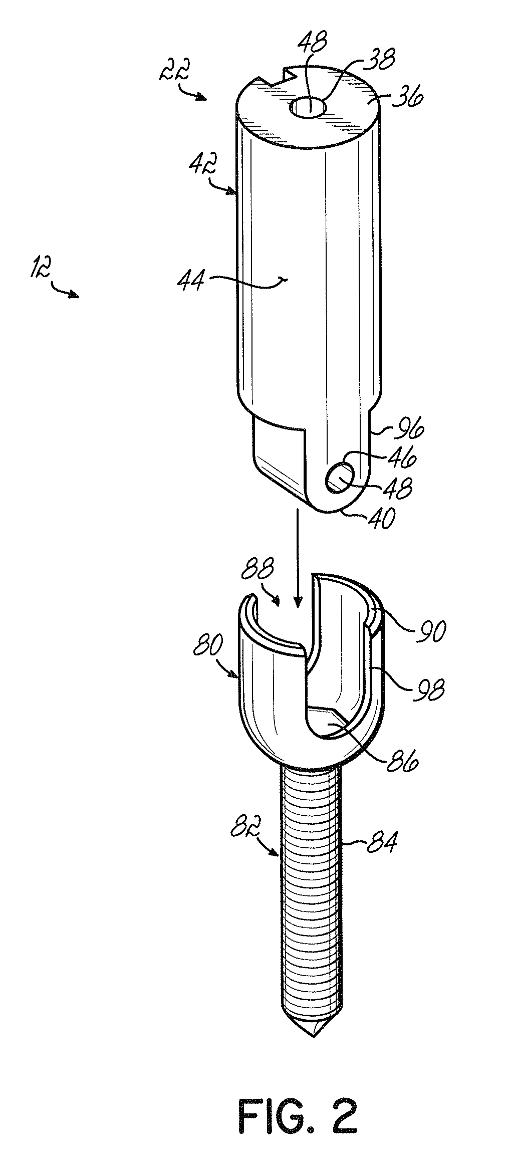System and method for minimally invasive spinal surgery
