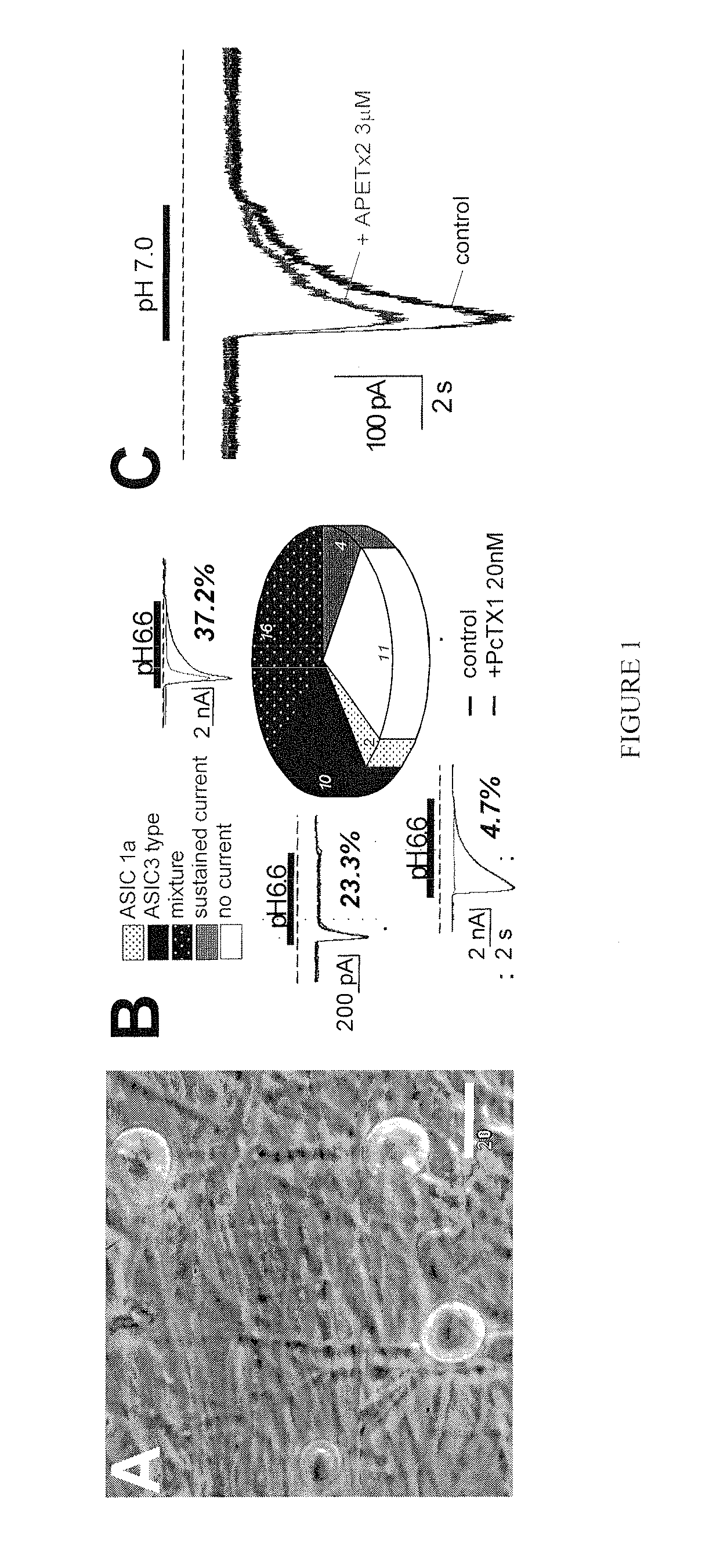 Method of treating pain or itching with APETx2 peptide toxin