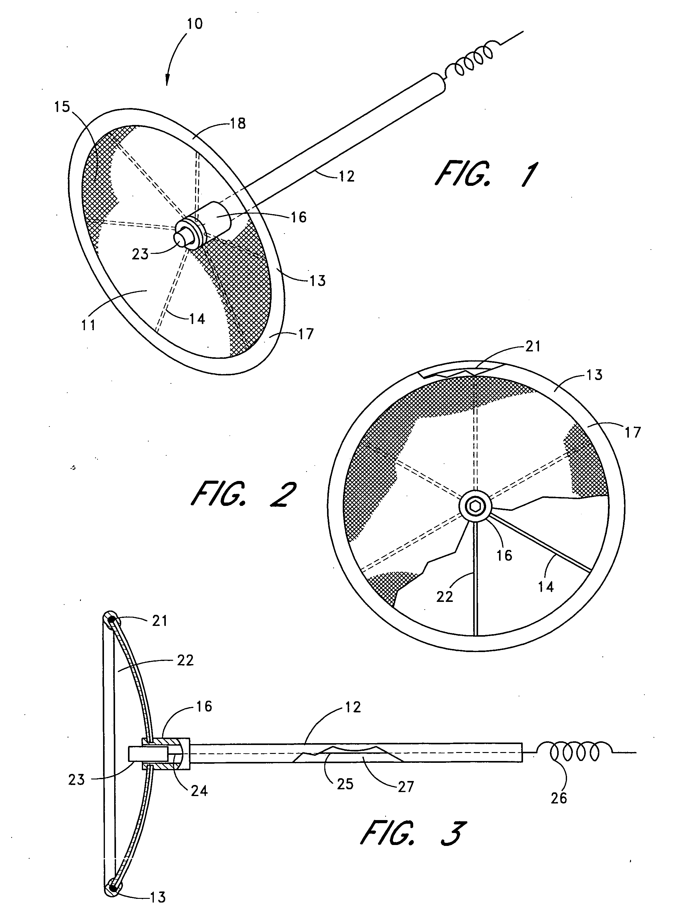 Method for left atrial appendage occlusion