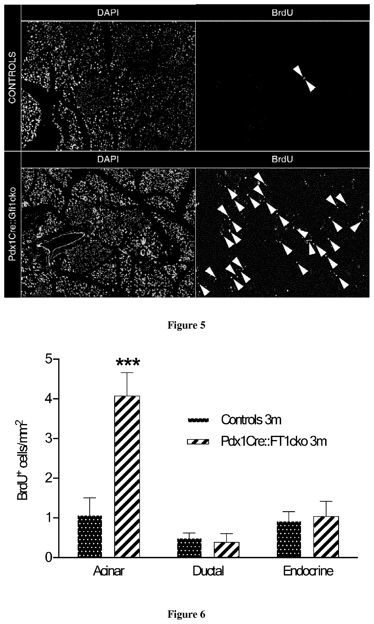 GFI1 inhibitors for the treatment of hyperglycemia