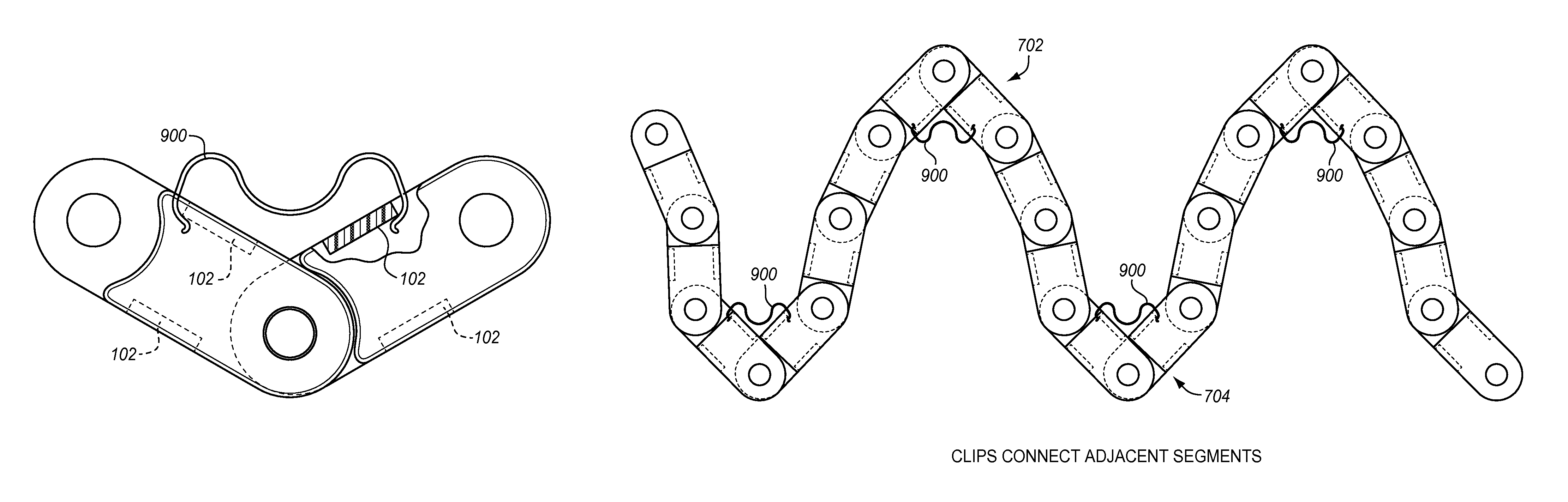 Systems and methods for tool-less retractable storage of lengths of cable chain