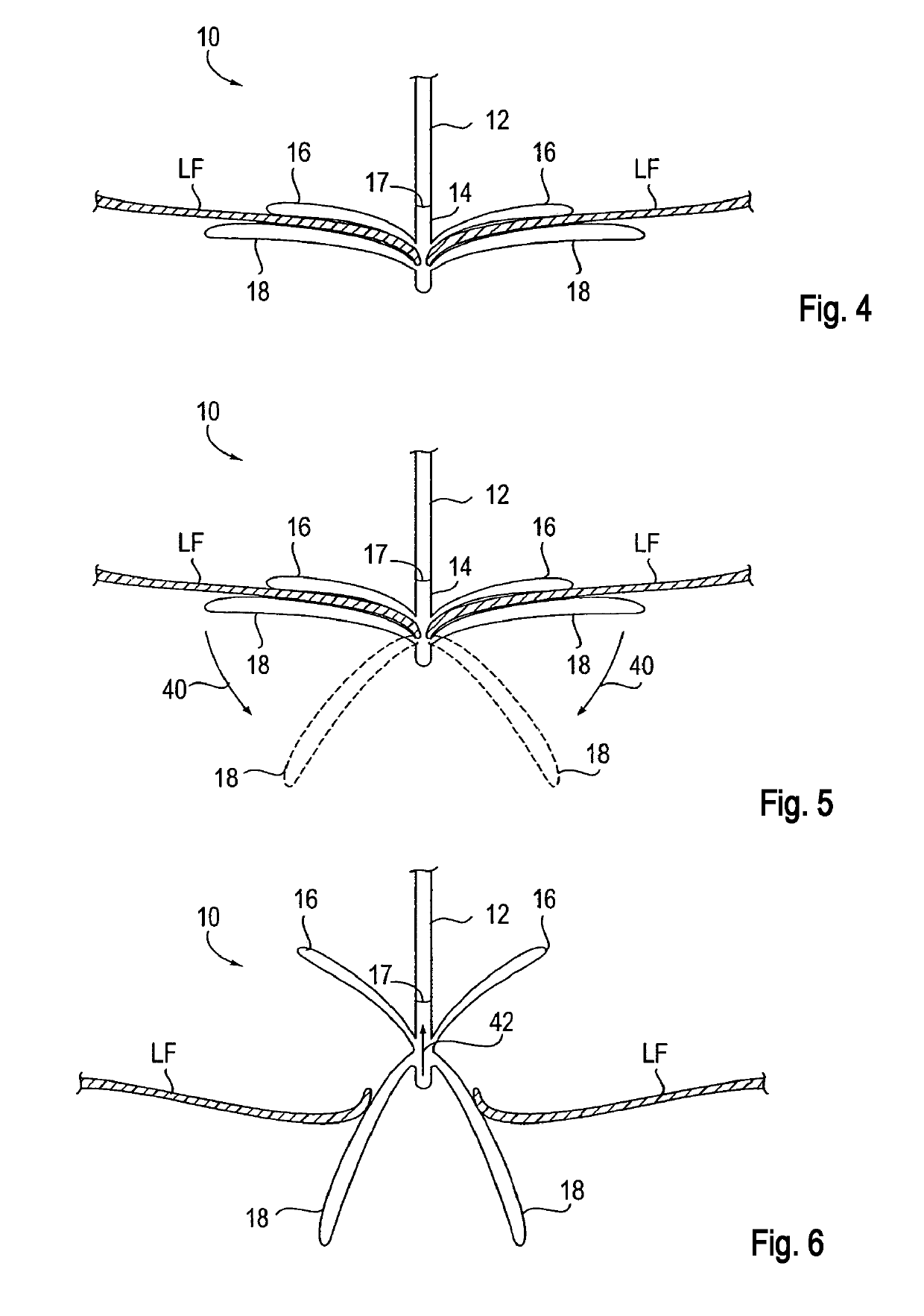 Delivery catheter handle and methods of use