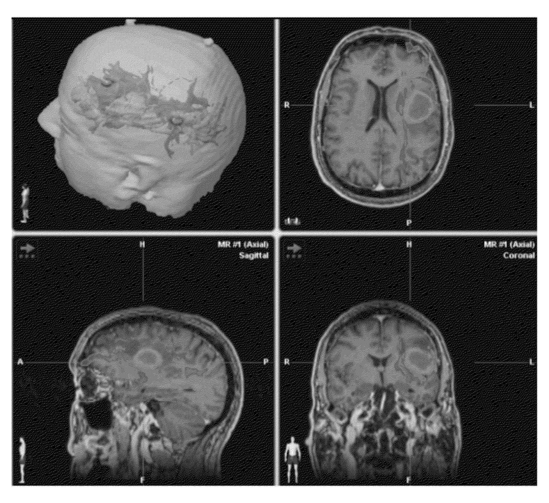 Method of rapidly visualizing essential neural pathways