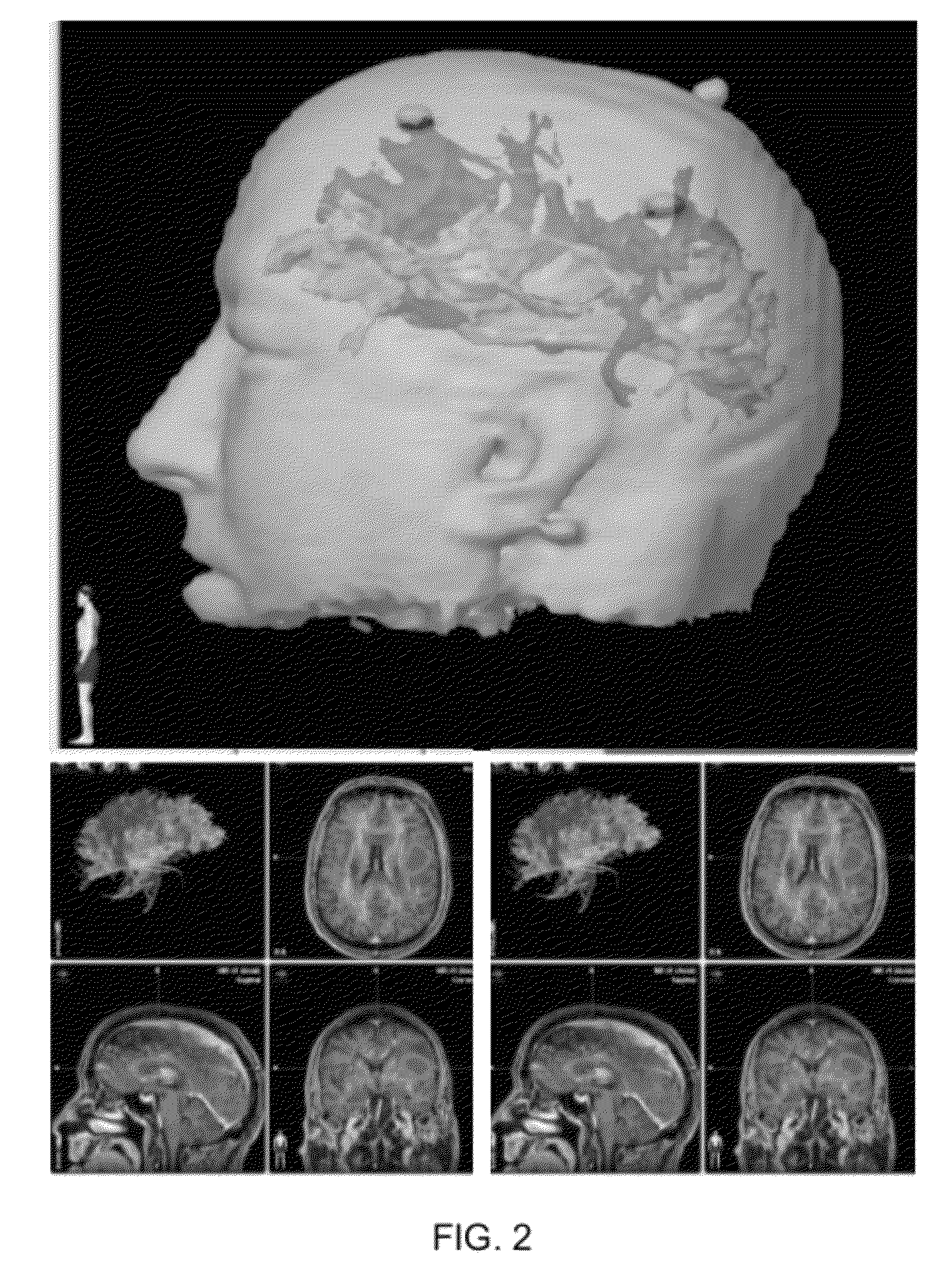 Method of rapidly visualizing essential neural pathways