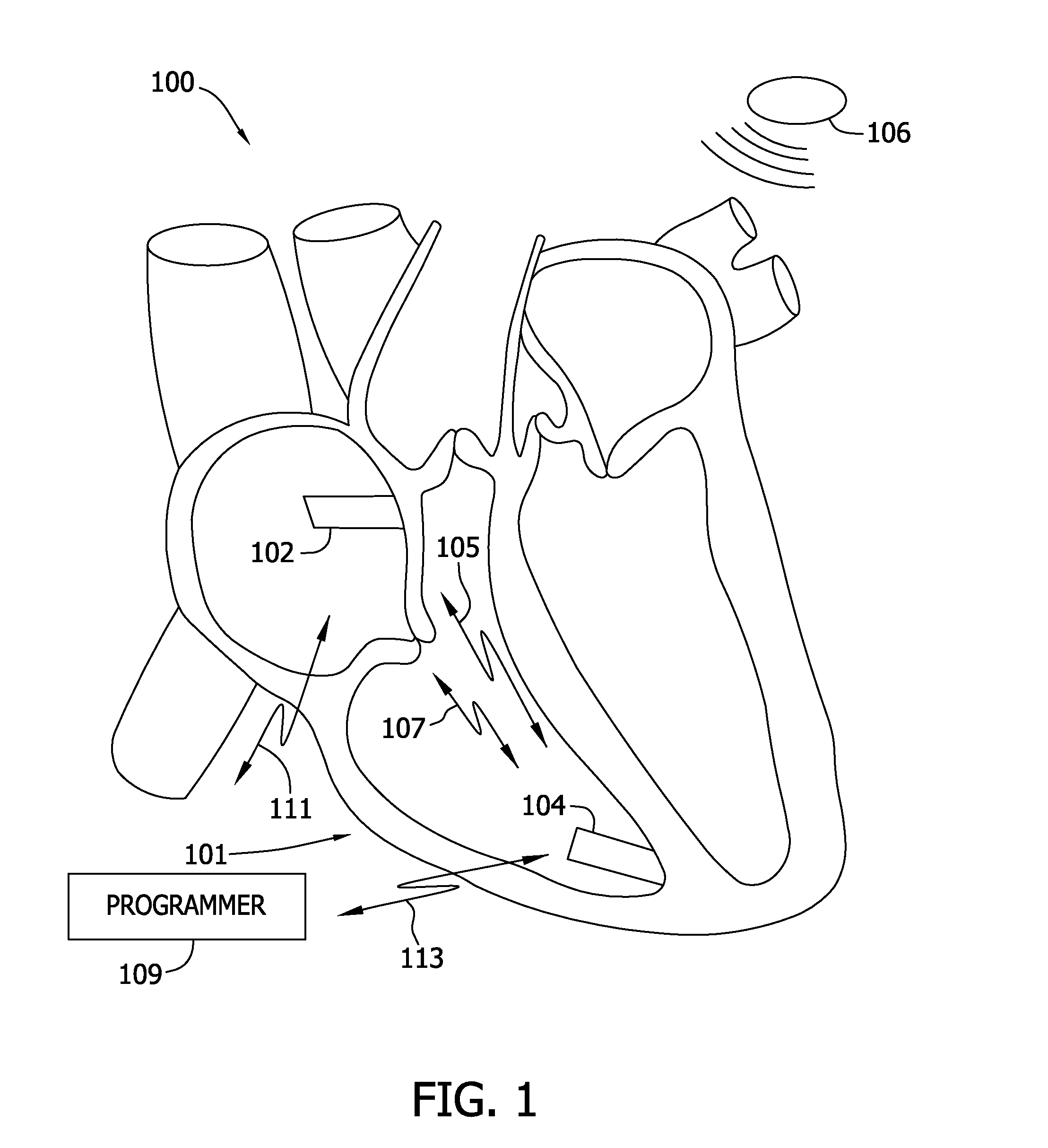 Dual chamber leadless pacemaker programmer and method