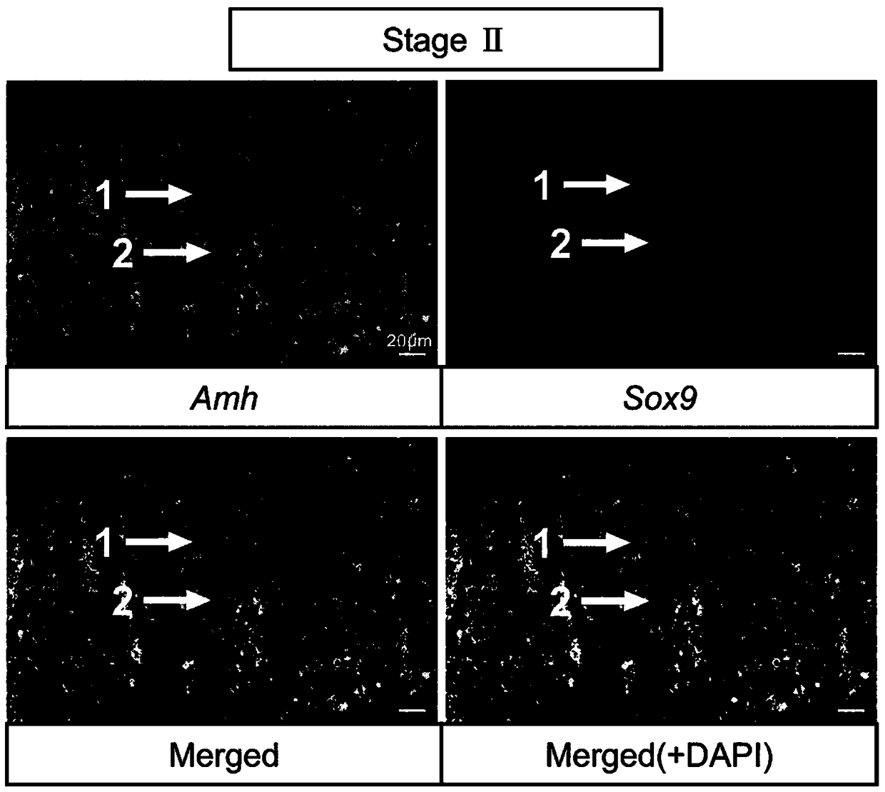 Method for marking germ cells and Sertoli cells of spermatogenic epithelium of turbot in different developmental stages and application