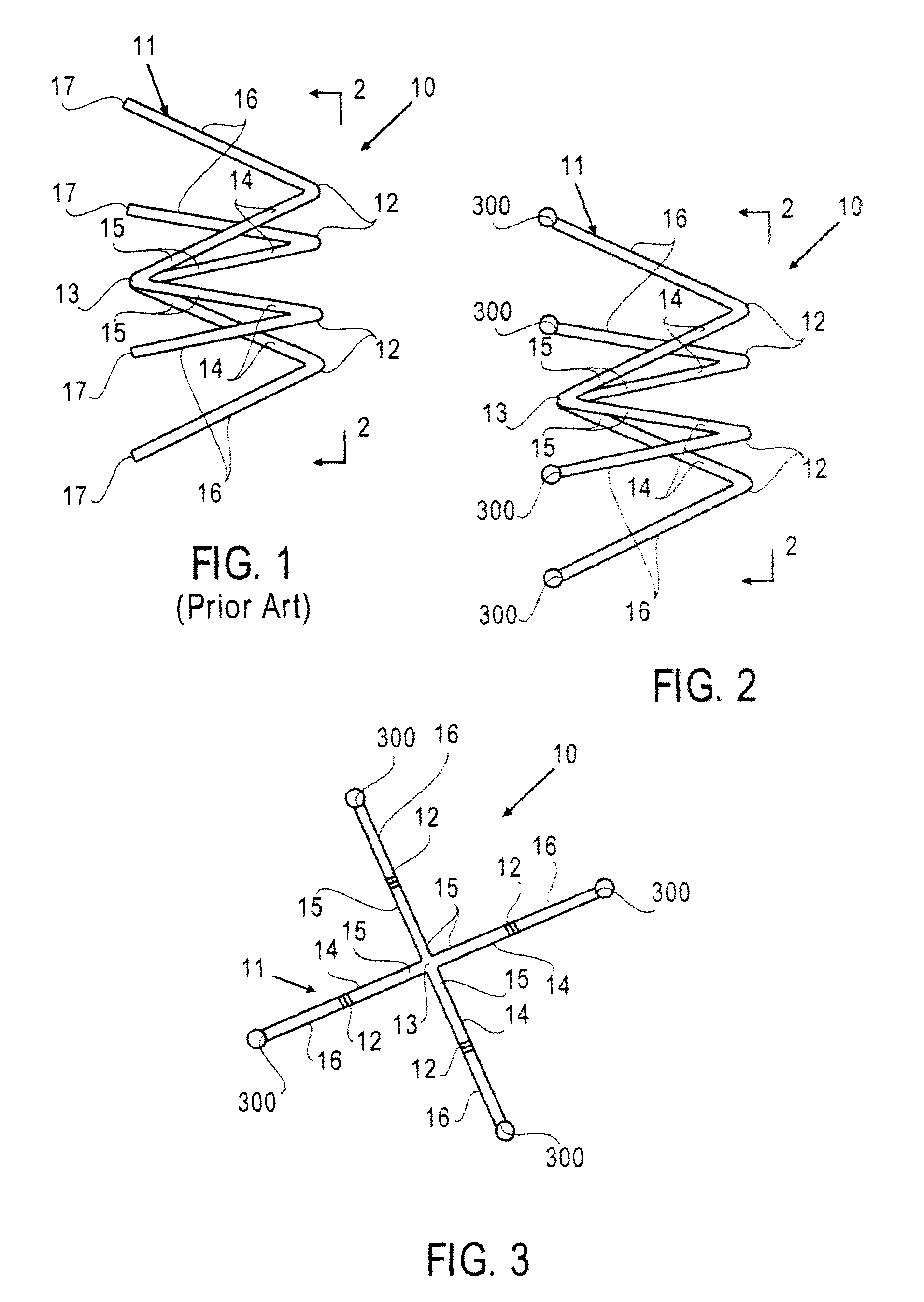 Methods and devices for deployment into a lumen