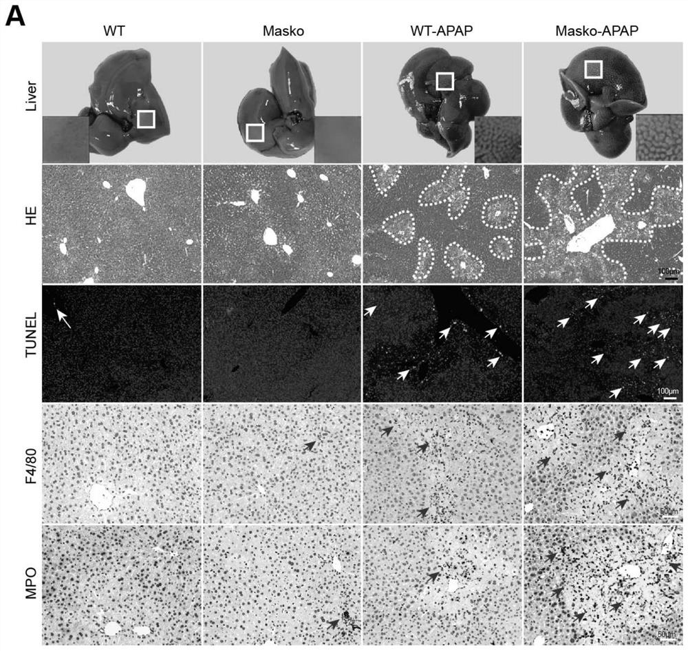 Application of specific excitation Mas receptor in prevention and treatment of acetaminophen-induced drug-induced liver injury