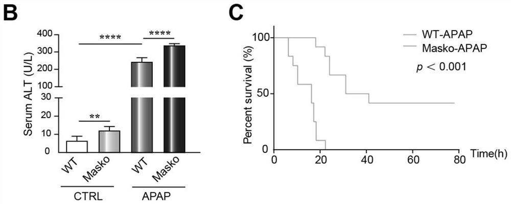 Application of specific excitation Mas receptor in prevention and treatment of acetaminophen-induced drug-induced liver injury