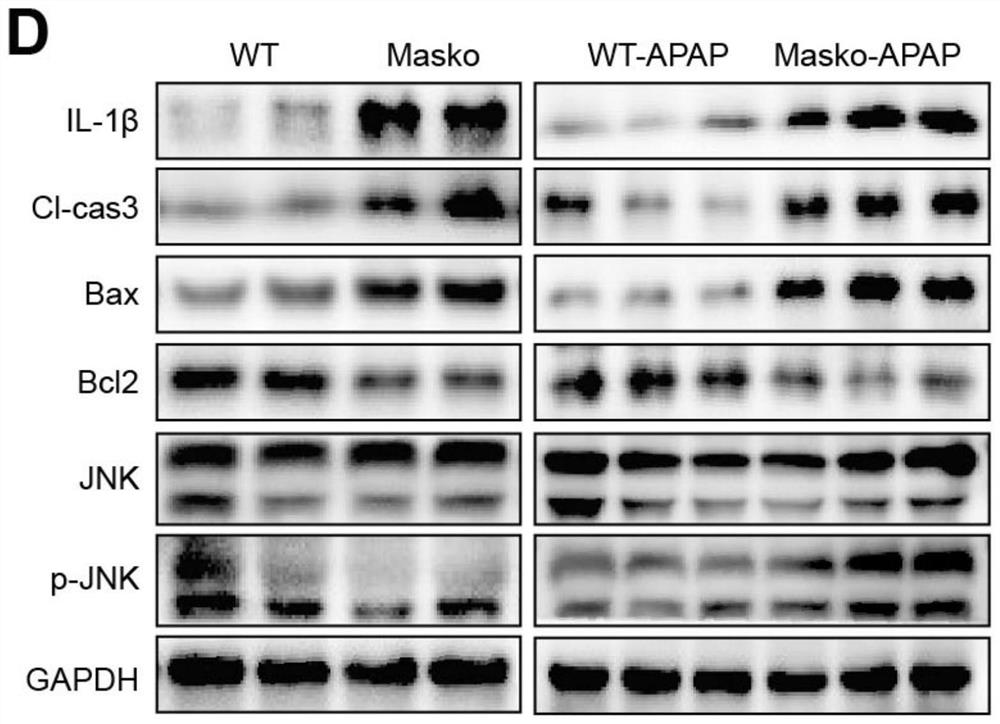 Application of specific excitation Mas receptor in prevention and treatment of acetaminophen-induced drug-induced liver injury