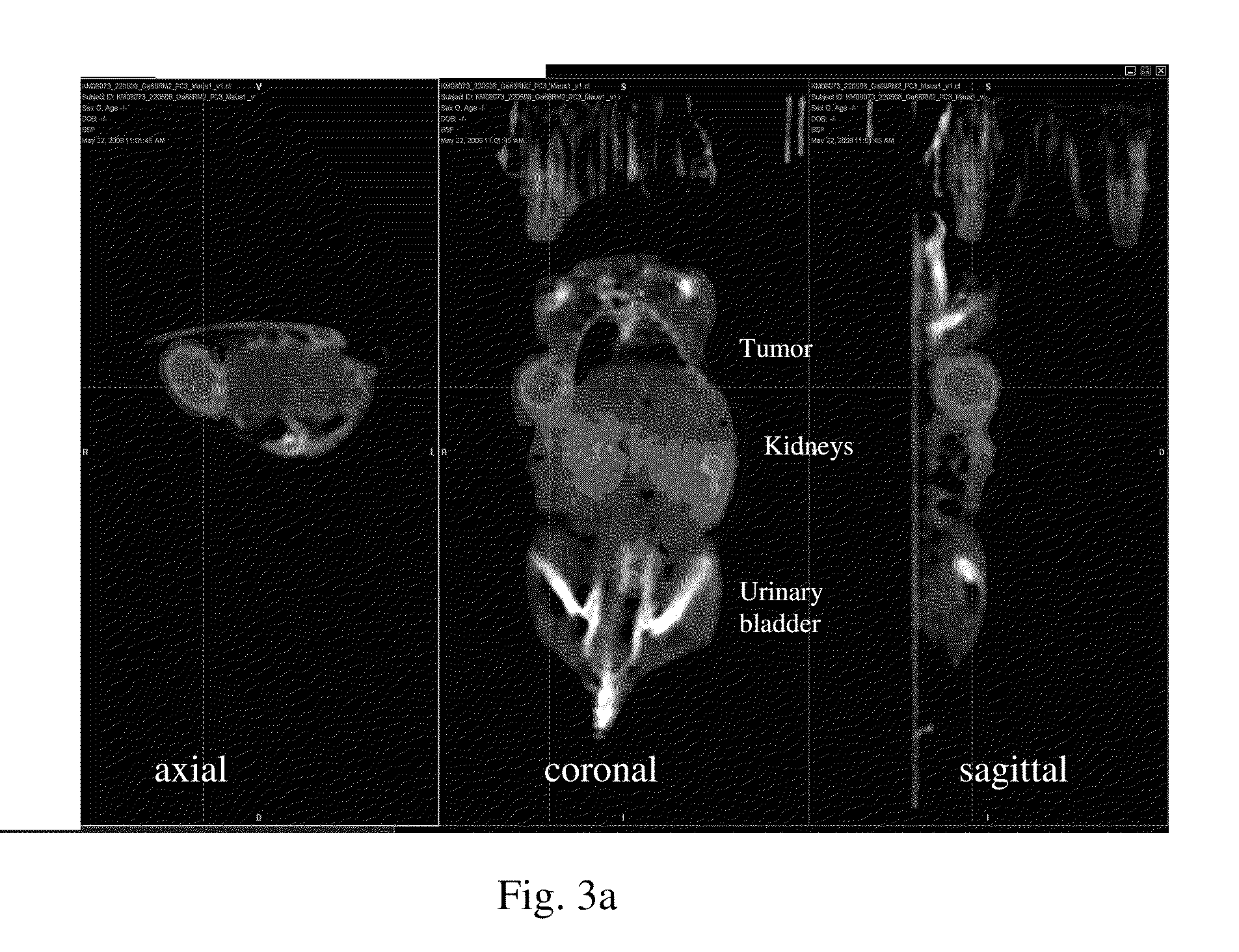 Bombesin analog peptide antagonist conjugates