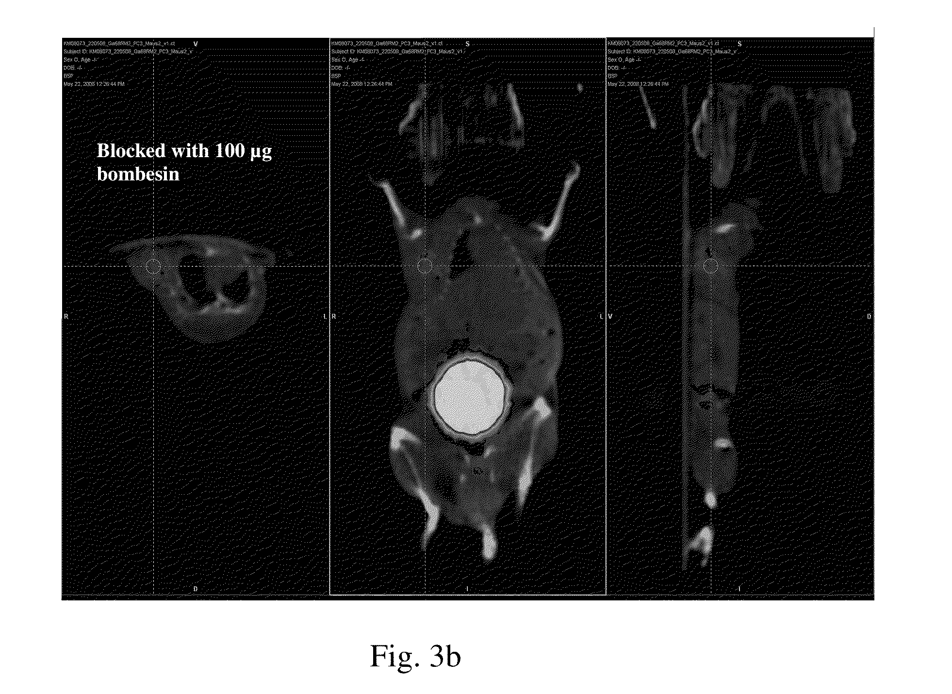 Bombesin analog peptide antagonist conjugates