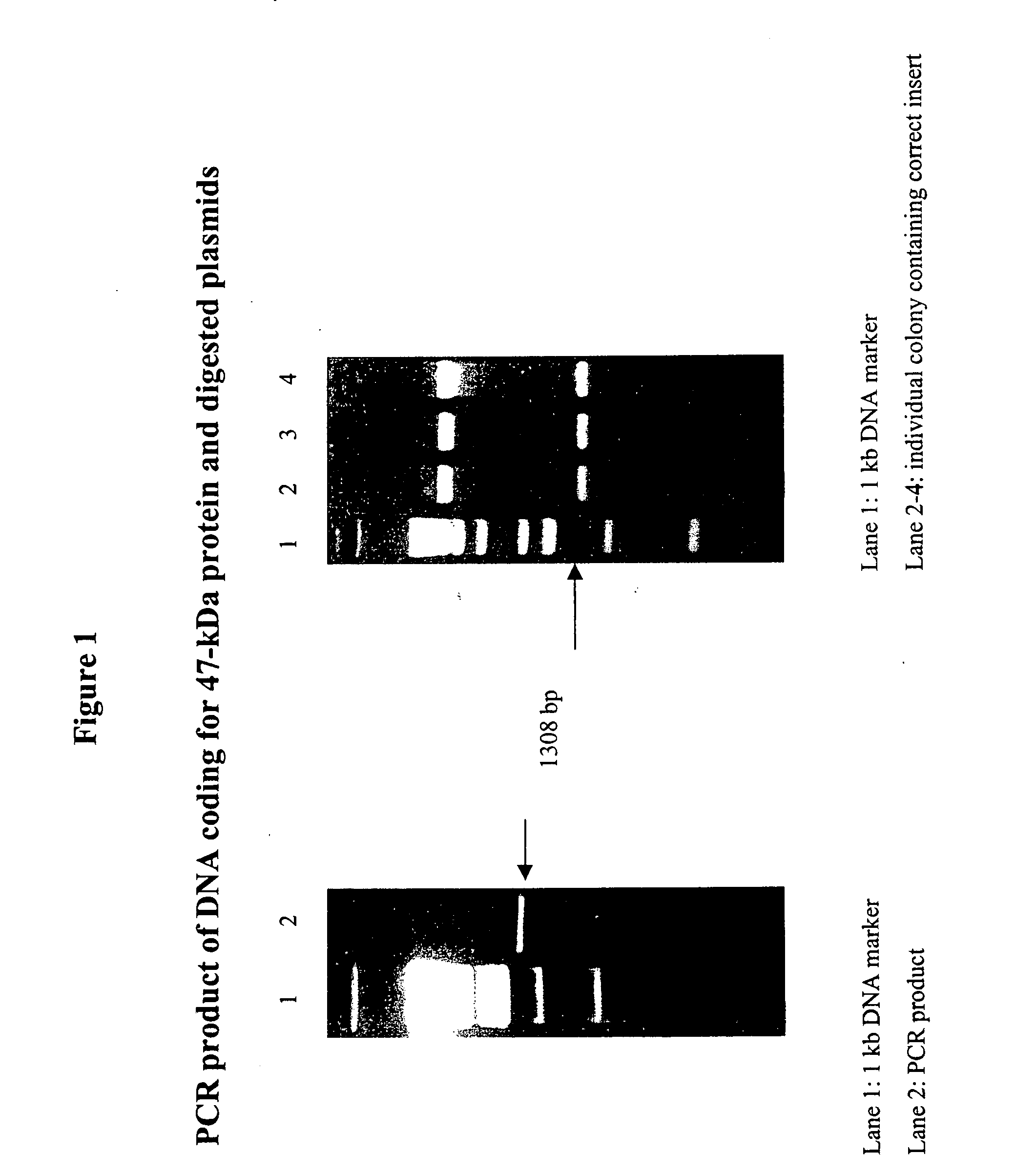 Orientia tsutsugamushi truncated recombinant outer membrane protein (r47) and (r56) vaccines diagnostics and therapeutics for scrub typhus and HIV infection