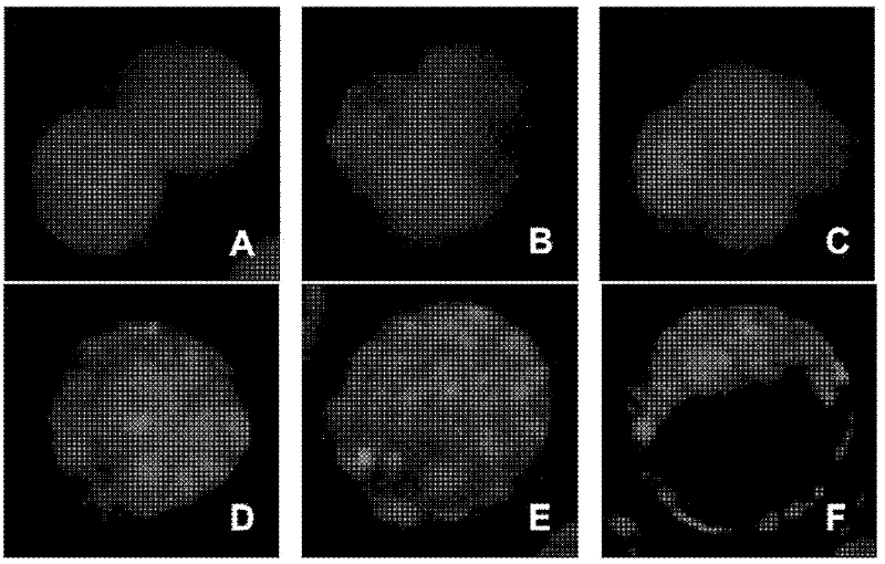 Method for transfection and implantation of pre-embryo by plasmid DNA (deoxyribonucleic acid) or antisense oligonucleotide