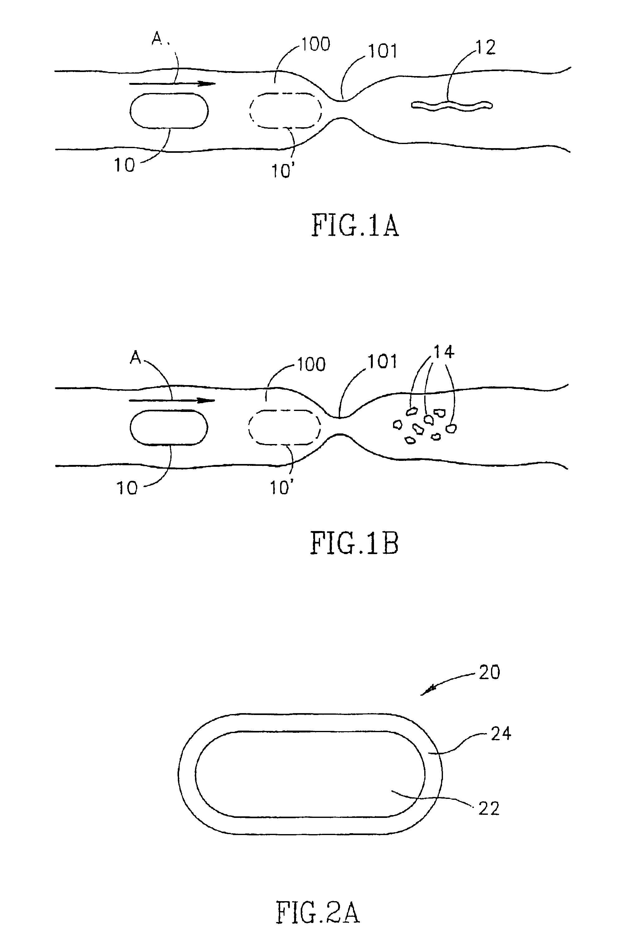 Device and method for examining a body lumen