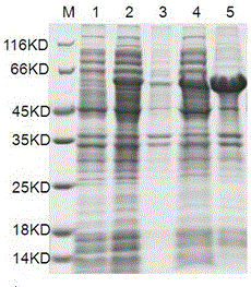 Preparation method and application of brucellosis specific fusion protein antigen