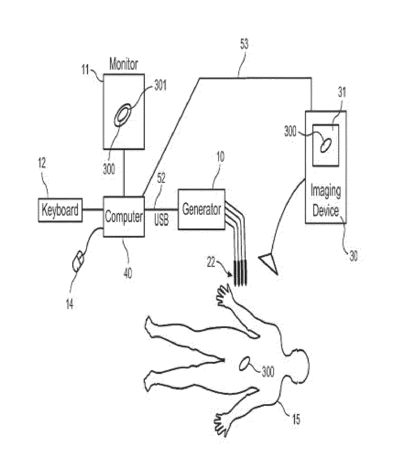 System and method for estimating a treatment volume for administering electrical-energy based therapies