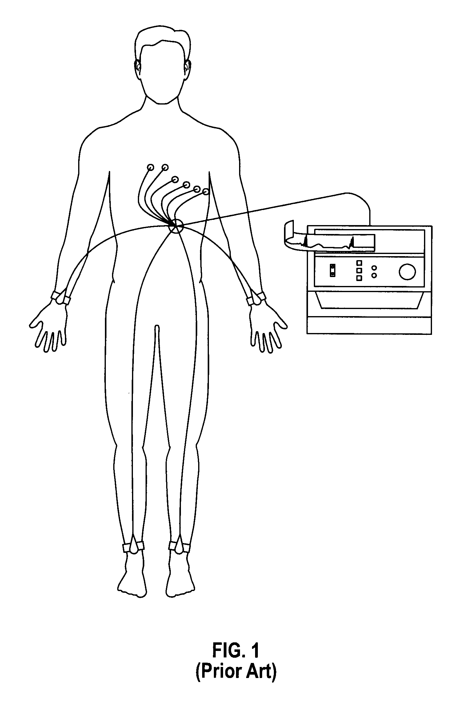 Two electrode apparatus and methods for twelve lead ECG