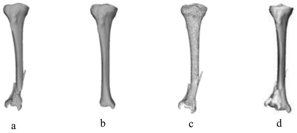 Template guiding and data driving three-dimensional broken bone segmentation and splicing method