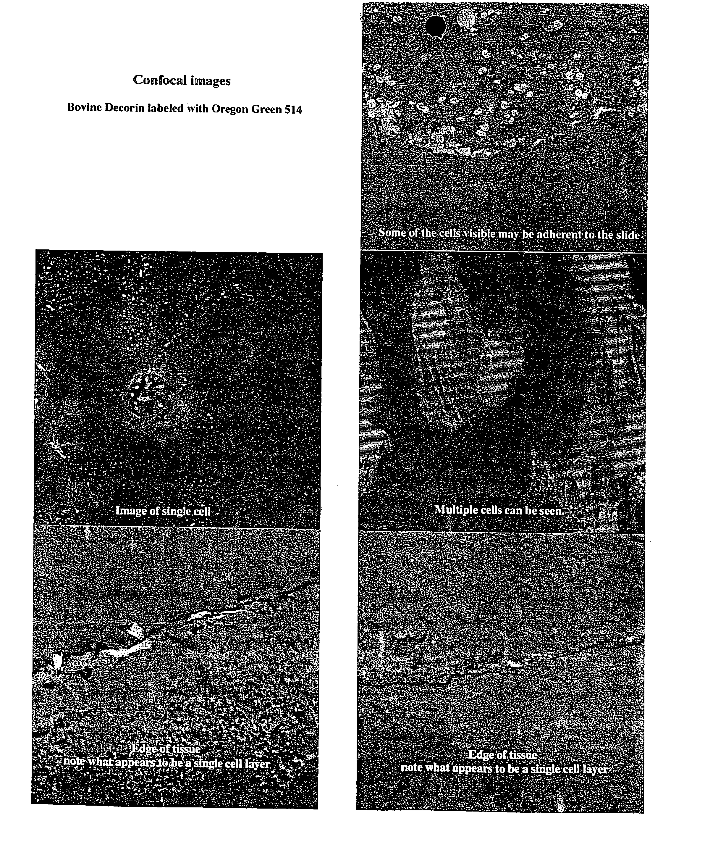 Composition for stabilizing corneal tissue during or after orthokeratology lens wear