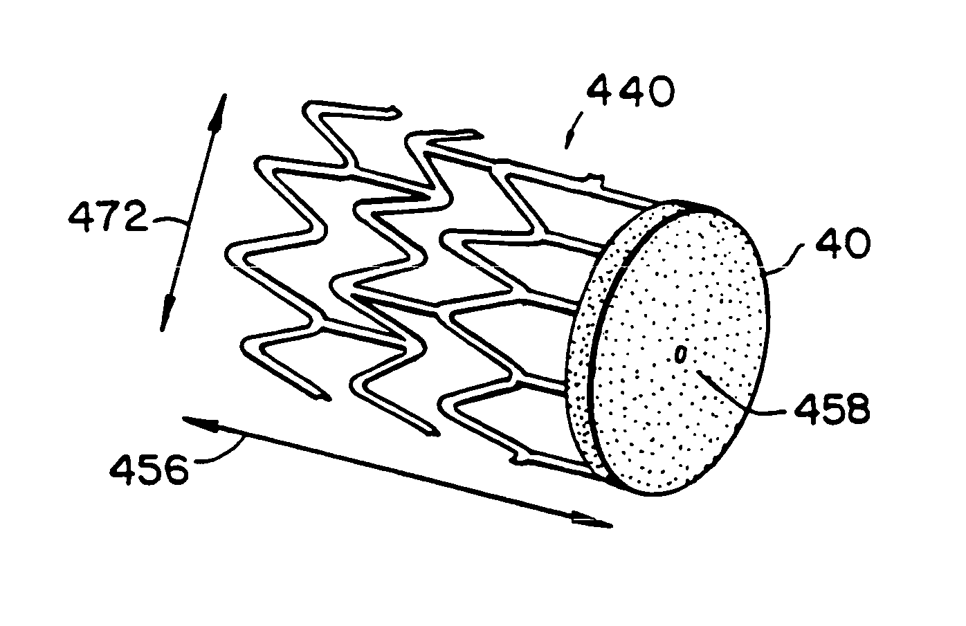 Filter apparatus for ostium of left atrial appendage