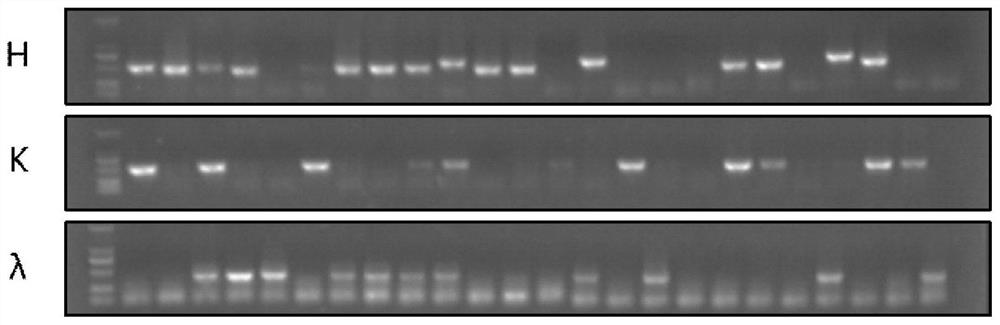 Anti-Ebola virus glycoprotein gp1 subunit monoclonal antibody 4f1 and its application