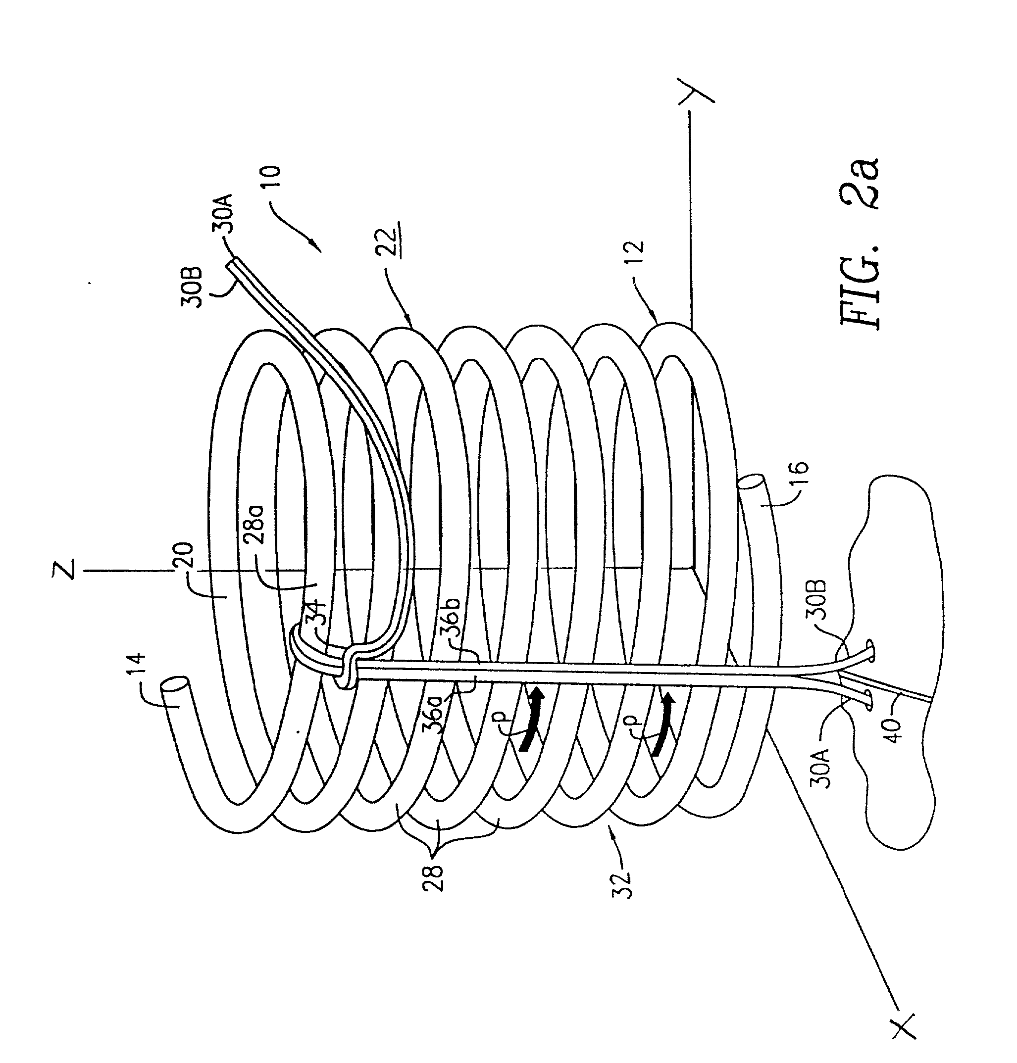 Suture anchoring and tensioning device and method for using same