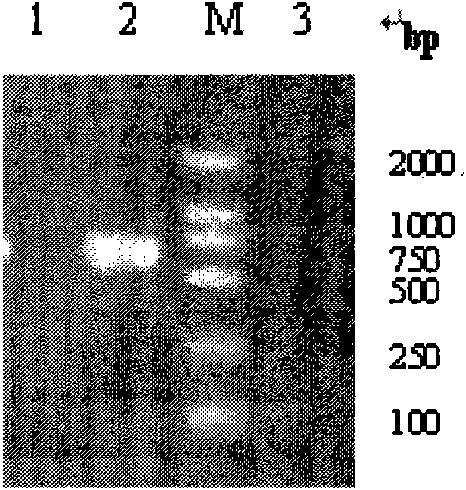 Application of adenovirus mediated interleukin-24 for preparing radiotherapy hypersitization medicine