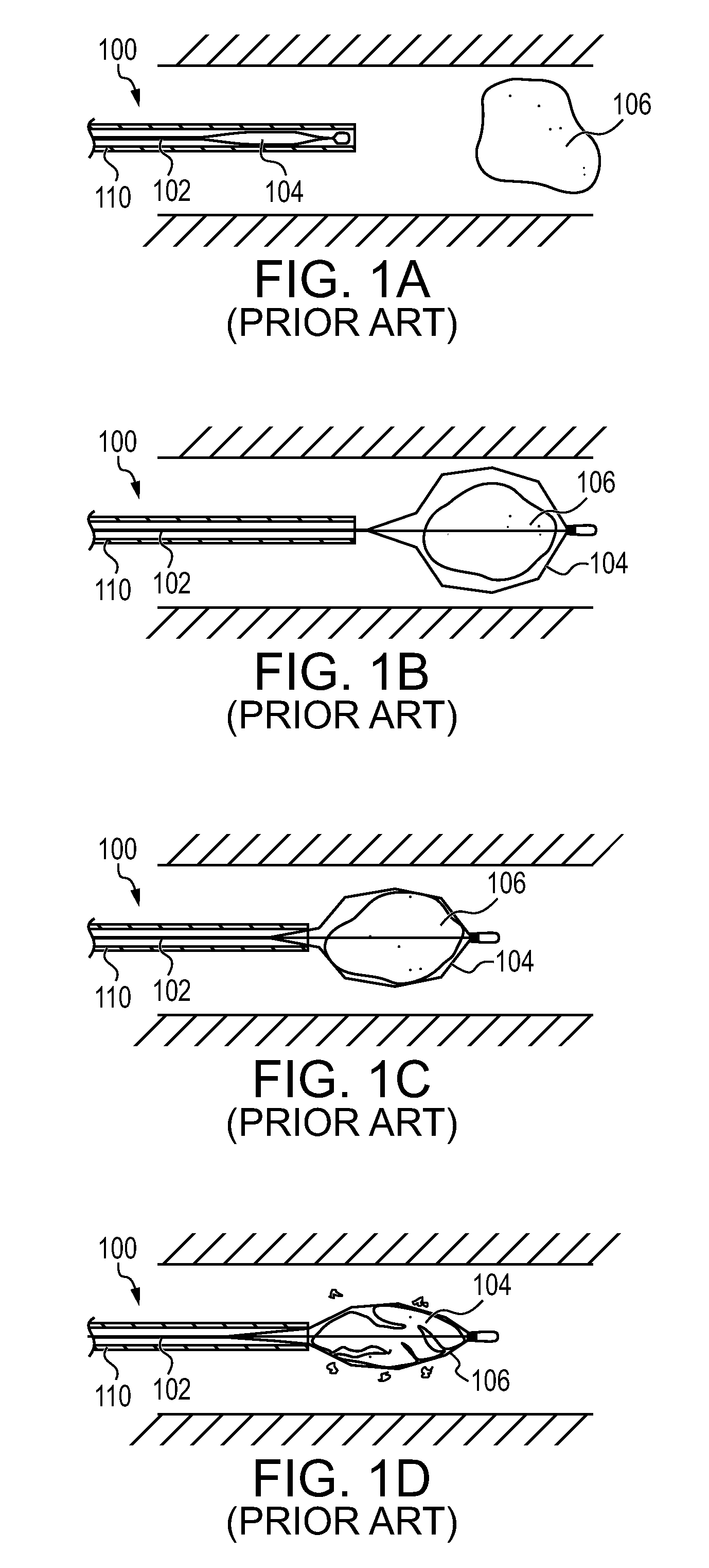 Handle for lithotripsy basket device