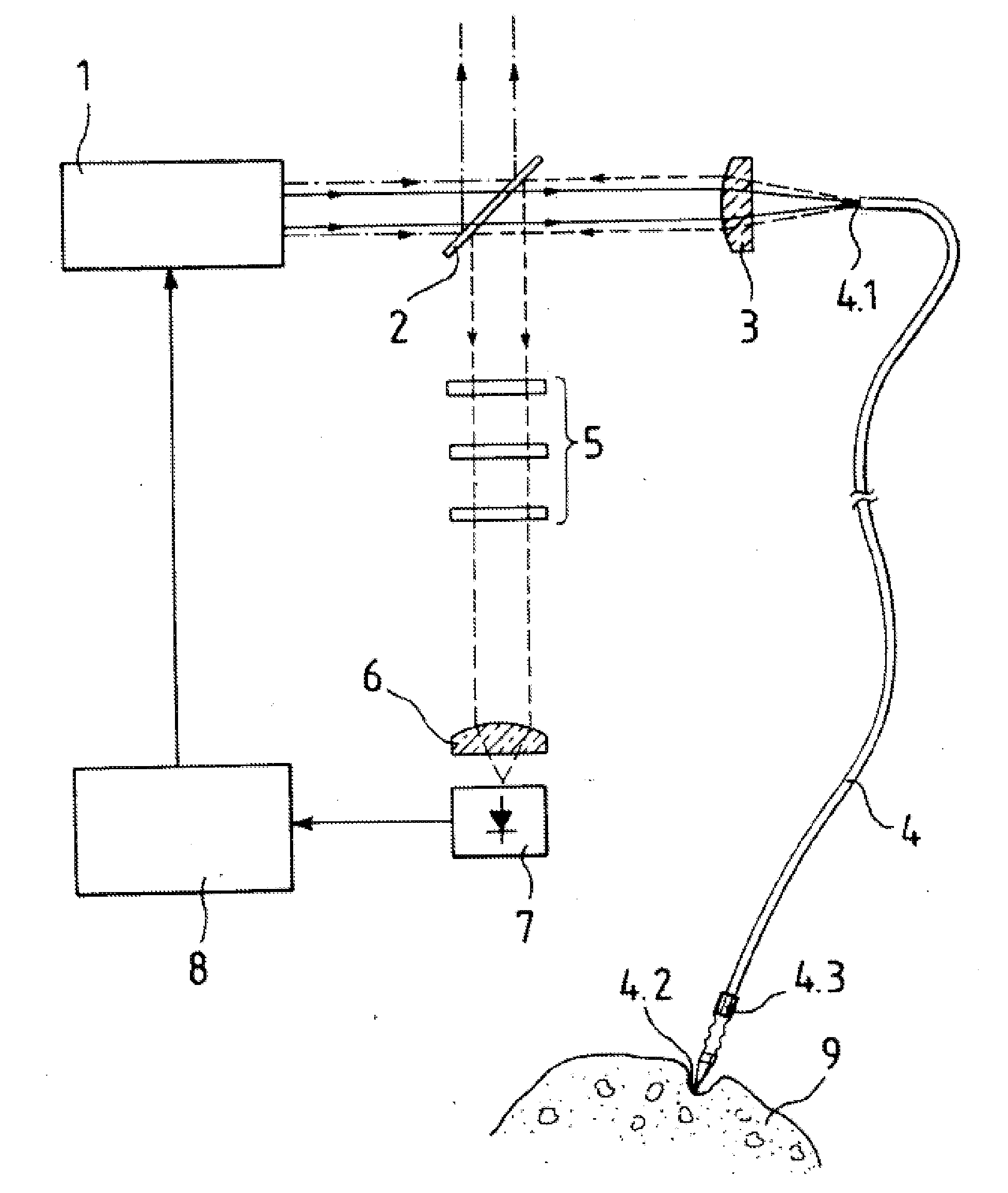 Laser-Based Lipolysis