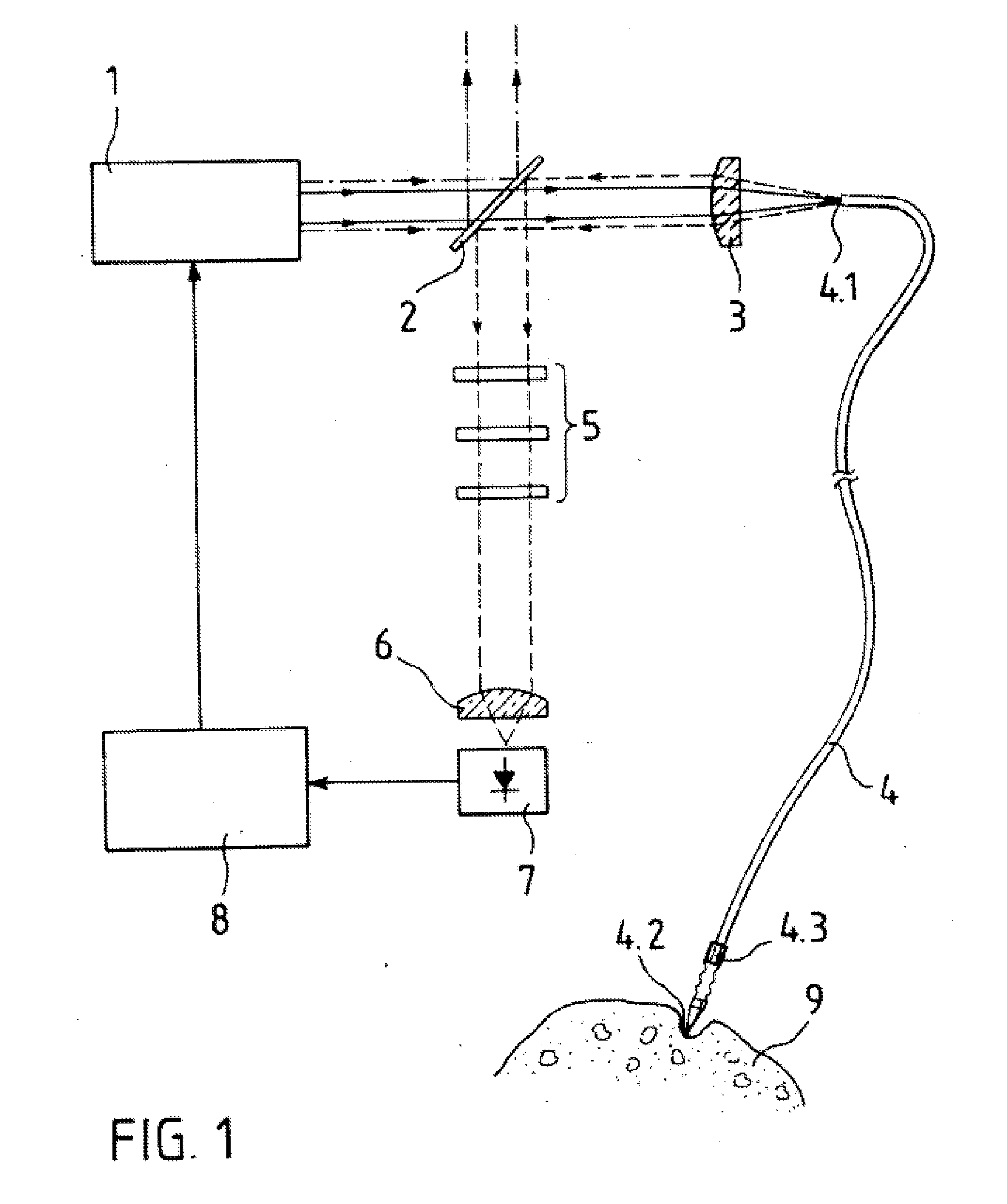 Laser-Based Lipolysis