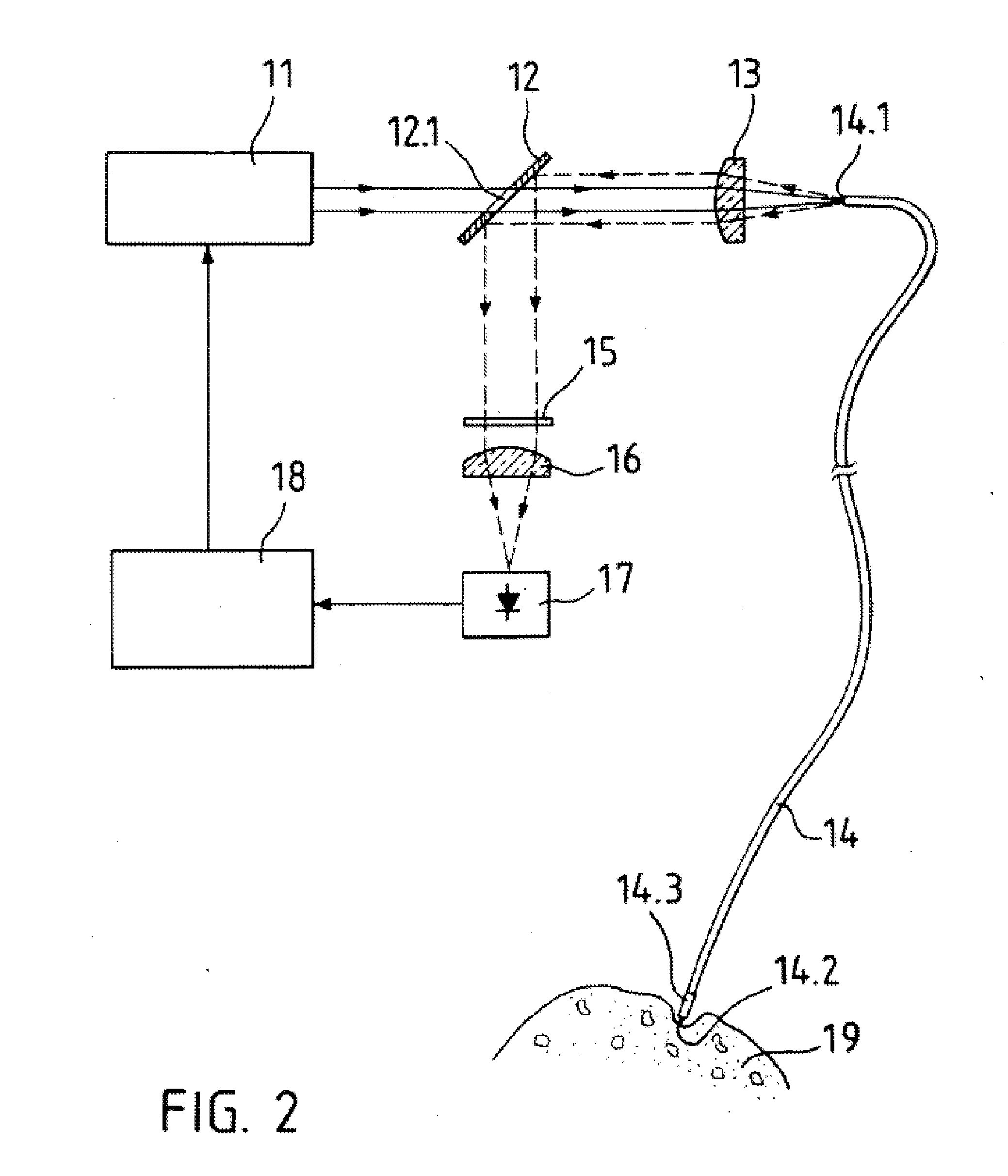 Laser-Based Lipolysis