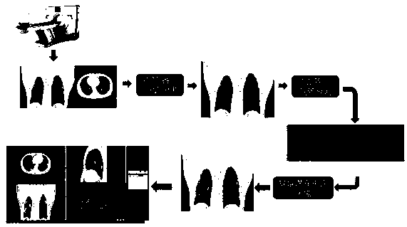 Image processing method and system for assisting diagnosis of pneumonia