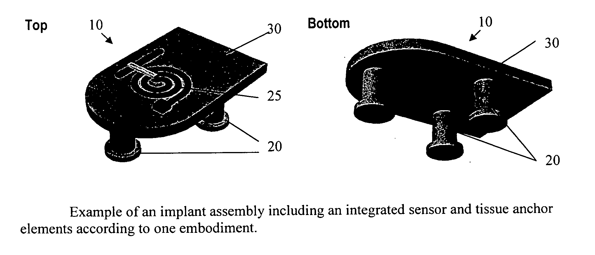 Micromachined tissue anchors for securing implants without sutures
