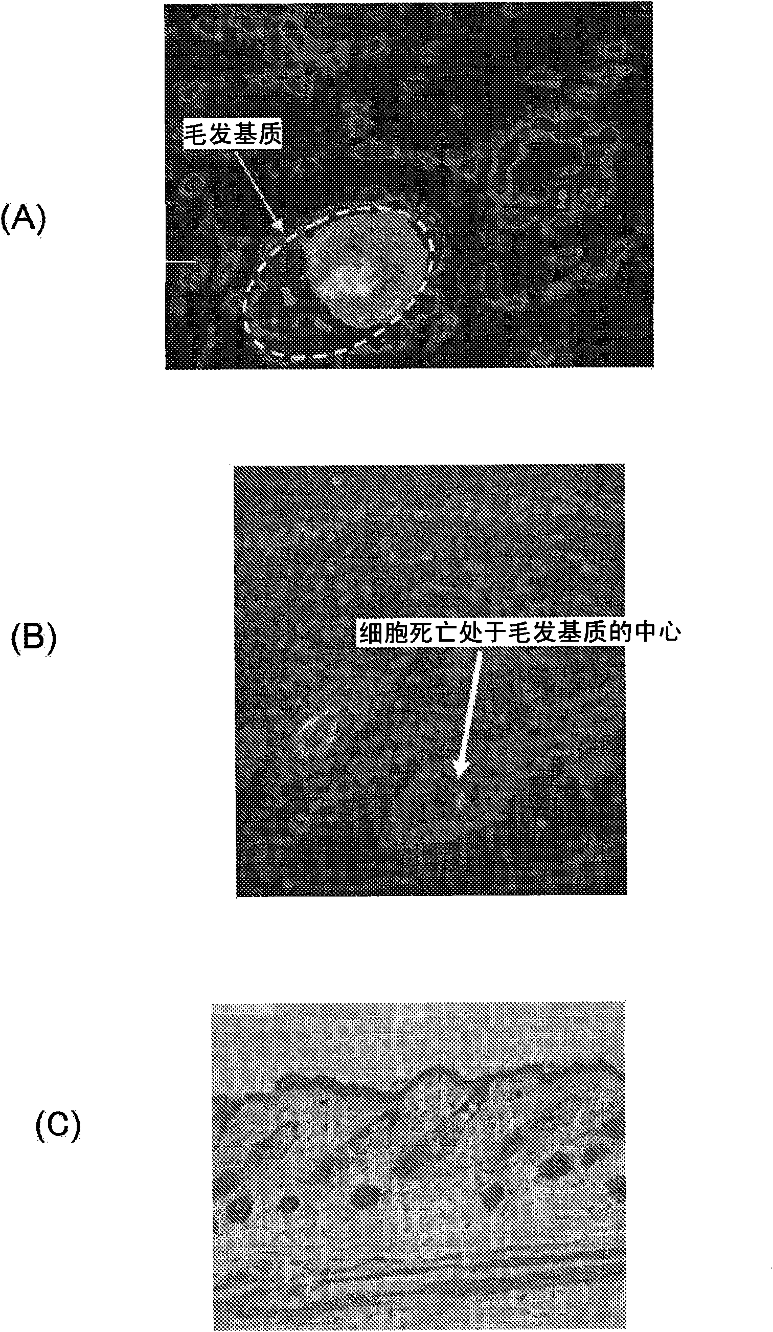 Hair growth control method and apparatus for the method