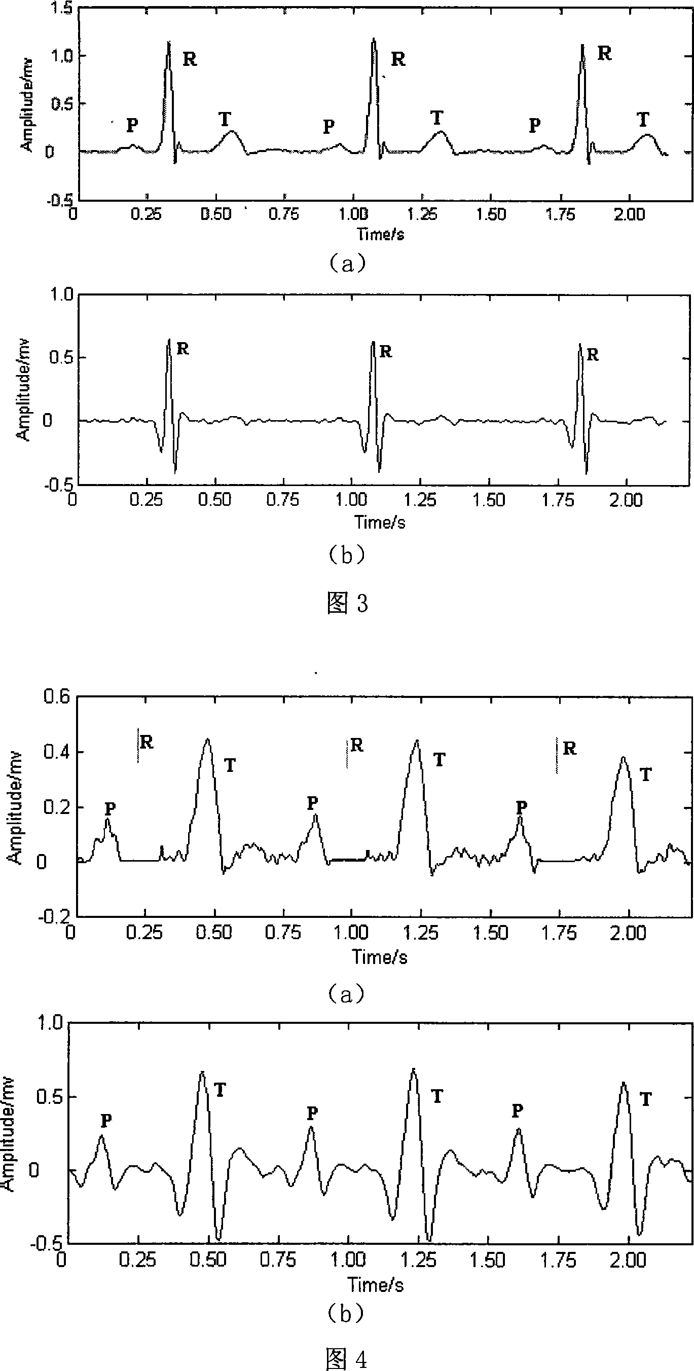 Cardioelectric characteristic extracting process based on evolutive wavelet wiener deconvolution